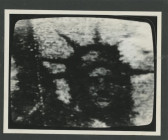 A granulated image of a figure's face resembling the Statue of Liberty.