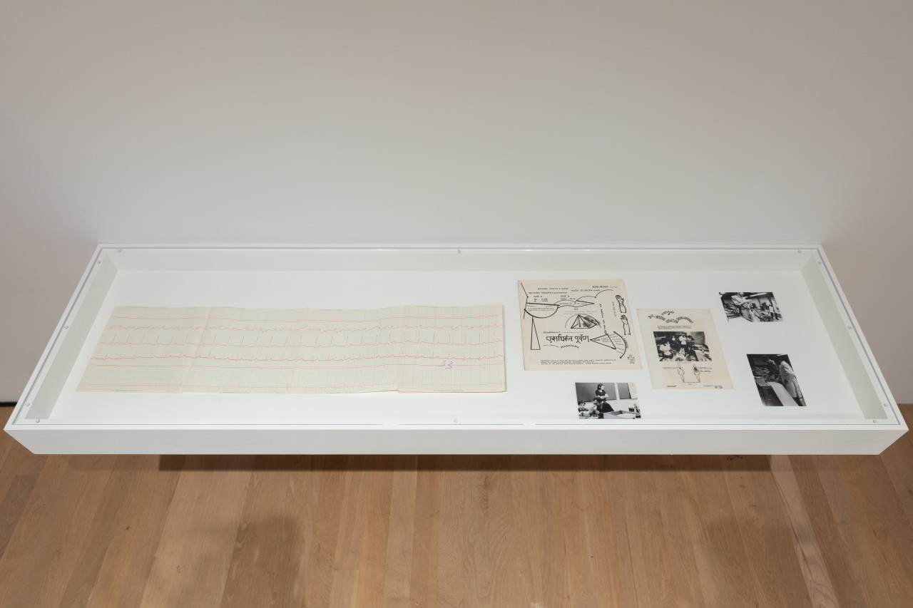 A color photograph of a vitrine containing an EKG printout and several black and white photographs.