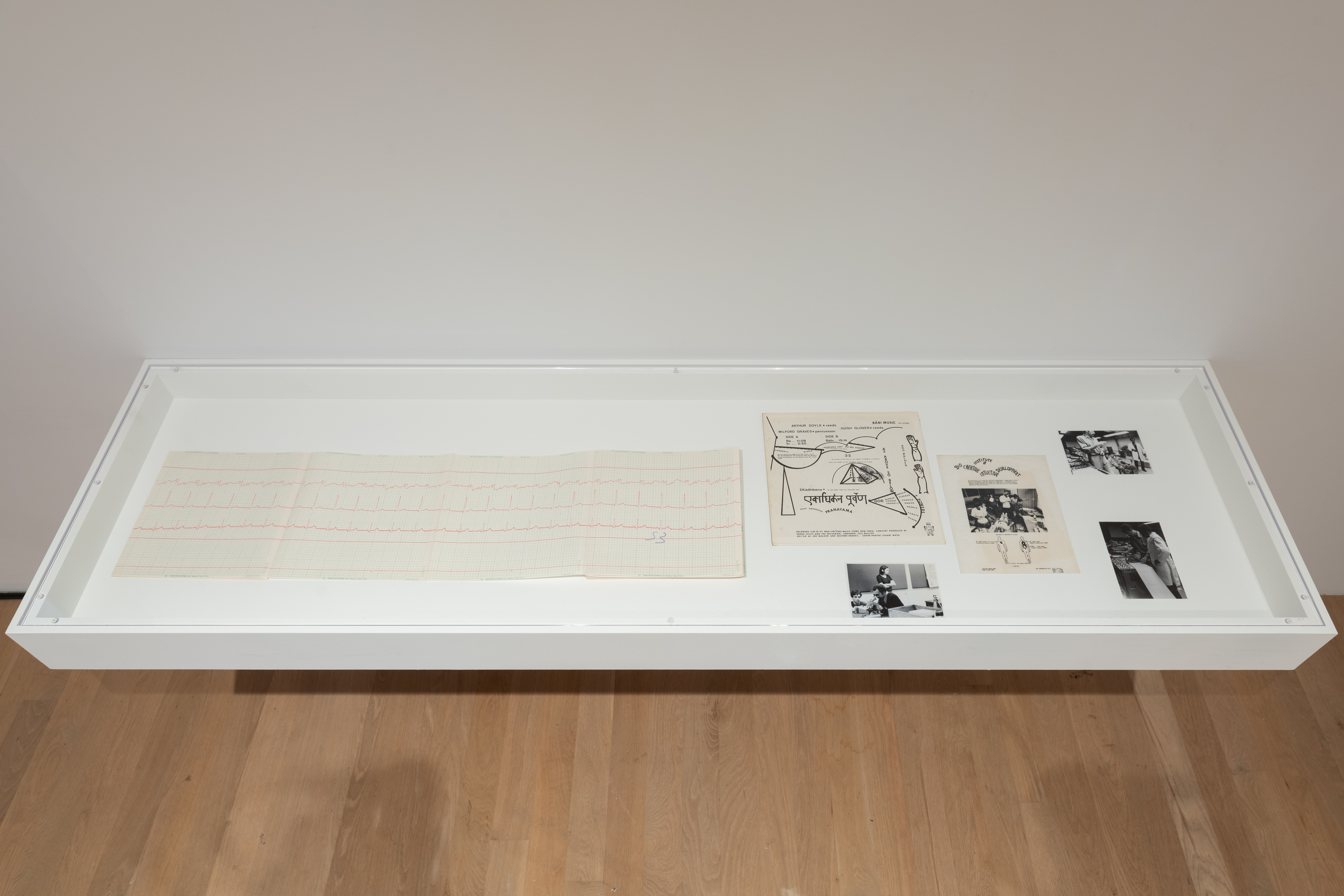 A color photograph of a vitrine containing an EKG printout and several black and white photographs.